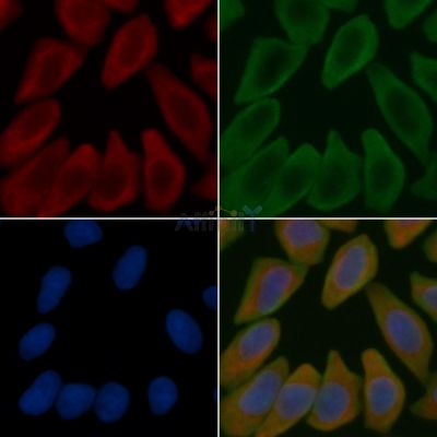MRPL9 Antibody - DF3675 staining Hela cells(45min of heat-shock treatment) by IF/ICC.