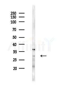 PGLS Antibody - Western blot analysis of lysates from Rat kidney, using PGLS Antibody at 1/1000 dilution.