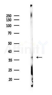 A4GNT Antibody - Western blot analysis of lysates from Mouse lung, using A4GNT Antibody at 1/1000 dilution.