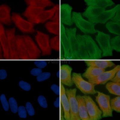 ARFIP1 Antibody - DF3790 staining Hela cells(45min of heat-shock treatment) by IF/ICC.