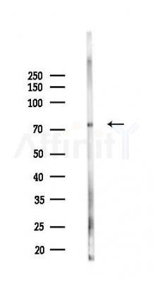 ABCB7 Antibody - Western blot analysis of lysates from COLO205 cells(heat-shock 45min treatment), using ABCB7 Antibody at 1/1000 dilution.