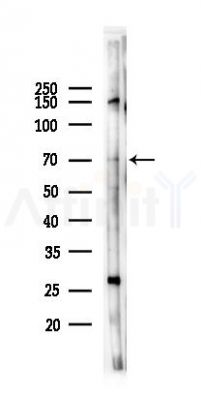 DDX55 Antibody - Western blot analysis of lysates from 293 cells(heat-shock 45min treatment), using DDX55 Antibody at 1/1000 dilution.