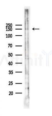 DHX8 Antibody - Western blot analysis of lysates from 293 cells(heat-shock 45min treatment), using DHX8 Antibody at 1/1000 dilution.