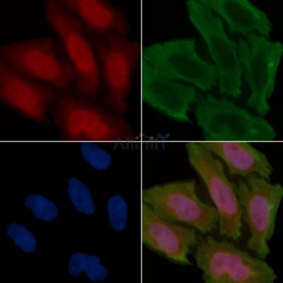 BRP16 Antibody - DF3851 staining Hela cells(45min of heat-shock treatment) by IF/ICC.