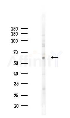 HUCE1 Antibody - Western blot analysis of lysates from COLO205 cells(heat-shock 45min treatment), using HUCE1 Antibody at 1/1000 dilution.