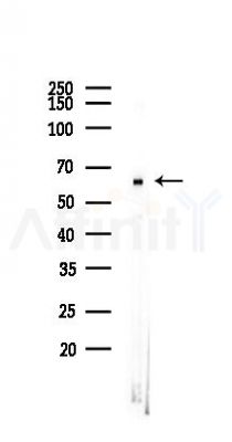 CSPG5 Antibody - Western blot analysis of lysates from 293 cells(heat-shock 45min treatment), using CSPG5 Antibody at 1/1000 dilution.