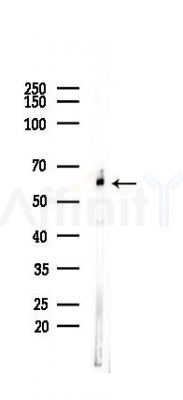 CSPG5 Antibody - Western blot analysis of lysates from Rat brain, using CSPG5 Antibody at 1/1000 dilution.