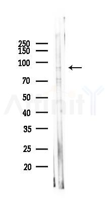 CHSY2 Antibody - Western blot analysis of lysates from 293 cells(heat-shock 45min treatment), using CHSY2 Antibody at 1/1000 dilution.