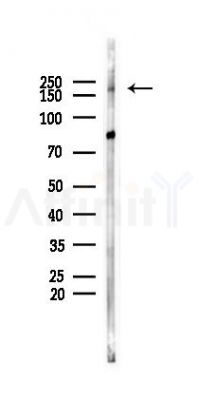 CLASP1 Antibody - Western blot analysis of lysates from B16F10-LUC cells(LPS 4h treatment), using CLASP1 Antibody at 1/1000 dilution.