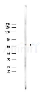 CD3EAP Antibody - Western blot analysis of lysates from 293 cells(LPS 4h treatment), using CD3EAP Antibody at 1/1000 dilution.