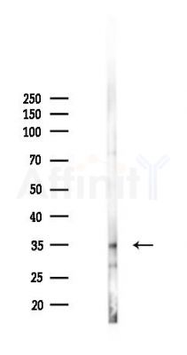 RPC4 Antibody - Western blot analysis of lysates from RAW264.