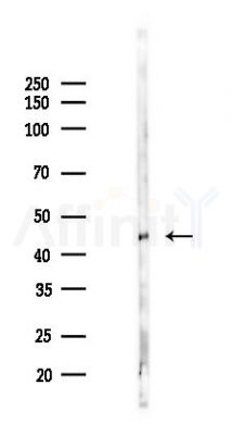EIF3F Antibody - Western blot analysis of lysates from PC12 cells(heat-shock 45min treatment), using EIF3F Antibody at 1/1000 dilution.