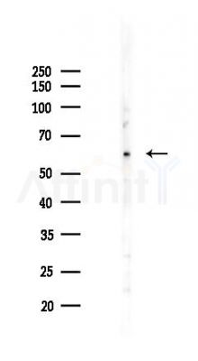 EIF3D Antibody - Western blot analysis of lysates from Mouse lung, using EIF3D Antibody at 1/1000 dilution.