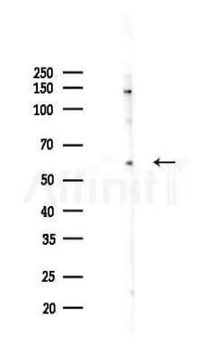 EIF3D Antibody - Western blot analysis of lysates from PC12 cells(heat-shock 45min treatment), using EIF3D Antibody at 1/1000 dilution.
