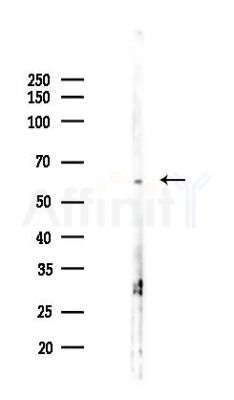 FBLN5 Antibody - Western blot analysis of lysates from PC12 cells(heat-shock 45min treatment), using FBLN5 Antibody at 1/1000 dilution.