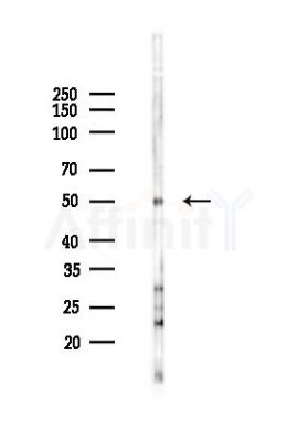 FBLN5 Antibody - Western blot analysis of lysates from Hela cells(UV 30min treatment), using FBLN5 Antibody at 1/1000 dilution.