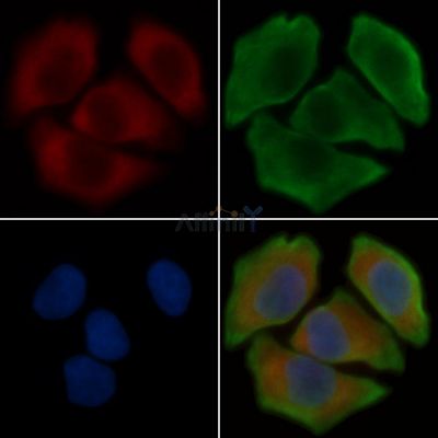 GRTP1 Antibody - DF4094 staining Hela cells(30min of UV treatment) by IF/ICC.