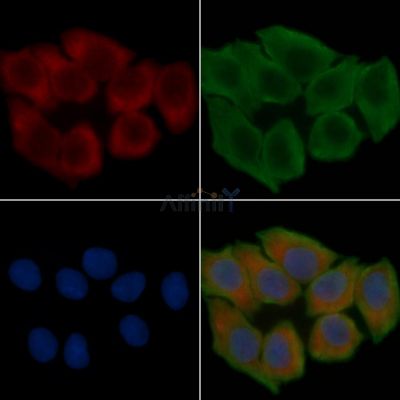 HNRPLL Antibody - DF4116 staining Hela cells(30min of UV treatment) by IF/ICC.