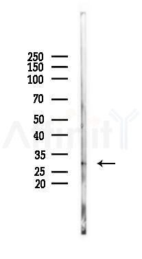 HLA-DPA1 Antibody - Western blot analysis of lysates from Mouse liver, using HLA-DPA1 Antibody at 1/1000 dilution.