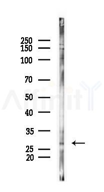 EMX1 Antibody - Western blot analysis of lysates from PC12 cells(UV 30min treatment), using EMX1 Antibody at 1/1000 dilution.