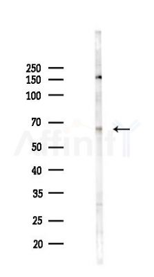 IQCB1 Antibody - Western blot analysis of lysates from COLO205 cells(heat-shock 45min treatment), using IQCB1 Antibody at 1/1000 dilution.
