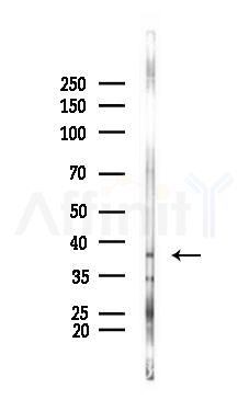 AASDHPPT Antibody - Western blot analysis of lysates from RAW264.
