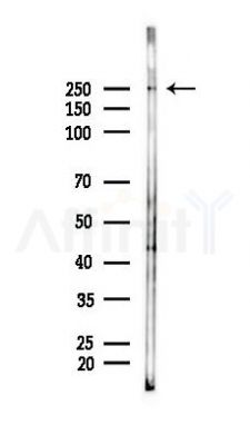 MRC1/CD206 Antibody - Western blot analysis of lysates from RAW264.