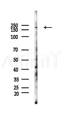 MRC1/CD206 Antibody - Western blot analysis of lysates from RAW264.