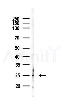 MDFI Antibody - Western blot analysis of lysates from PC12 cells(heat-shock 45min treatment), using MDFI Antibody at 1/1000 dilution.