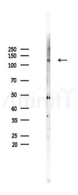 MYBPC1 Antibody - Western blot analysis of lysates from 293 cells(LPS 4h treatment), using MYBPC1 Antibody at 1/1000 dilution.