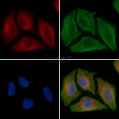 ME3 Antibody - DF4218 staining Hela cells(30min of UV treatment) by IF/ICC.