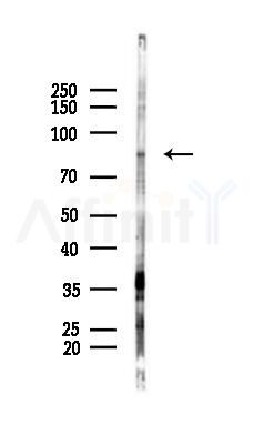 NOC2L Antibody - Western blot analysis of lysates from PC12 cells(UV 30min treatment), using NOC2L Antibody at 1/1000 dilution.