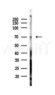N4BP2L2 Antibody - Western blot analysis of lysates from COLO205 cells(heat-shock 45min treatment), using N4BP2L2 Antibody at 1/1000 dilution.