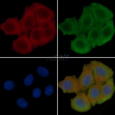 KCNK15 Antibody - DF4307 staining Hela cells(45min of heat-shock treatment) by IF/ICC.