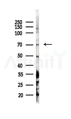 KCND1 Antibody - Western blot analysis of lysates from COLO205 cells(heat-shock 45min treatment), using KCND1 Antibody at 1/1000 dilution.