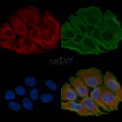 NDRG4 Antibody - DF4341 staining Hela cells(45min of heat-shock treatment) by IF/ICC.