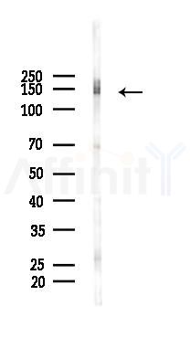 PLEKHG4 Antibody - Western blot analysis of lysates from K562 cells(heat-shock 45min treatment), using PLEKHG4 Antibody at 1/1000 dilution.
