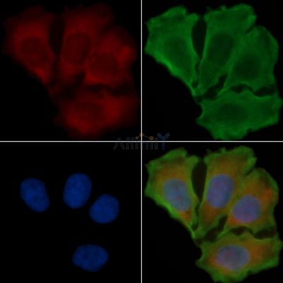 PLEKHG4 Antibody - DF4358 staining Hela cells(30min of UV treatment) by IF/ICC.