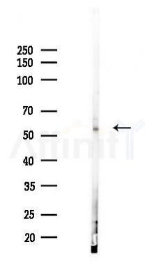 APOBEC4 Antibody - Western blot analysis of lysates from Hela cells(UV 30min treatment), using APOBEC4 Antibody at 1/1000 dilution.