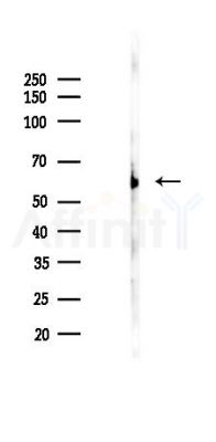 PWWP2B Antibody - Western blot analysis of lysates from Rat testis, using PWWP2B Antibody at 1/1000 dilution.