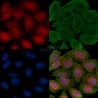 PWWP2B Antibody - DF4362 staining Hela cells(30min of UV treatment) by IF/ICC.