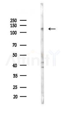 PC Antibody - Western blot analysis of lysates from Hela cells(UV 30min treatment), using PC Antibody at 1/1000 dilution.