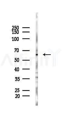 RABEP2 Antibody - Western blot analysis of lysates from K562 cells(heat-shock 45min treatment), using RABEP2 Antibody at 1/1000 dilution.