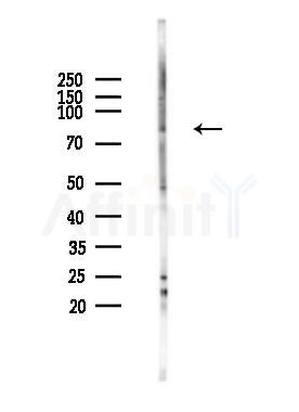 RDX Antibody - Western blot analysis of lysates from Mouse muscle, using RDX Antibody at 1/1000 dilution.