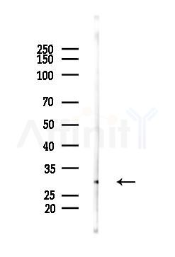 RASL10A Antibody - Western blot analysis of lysates from PC12 cells(UV 30min treatment), using RASL10A Antibody at 1/1000 dilution.