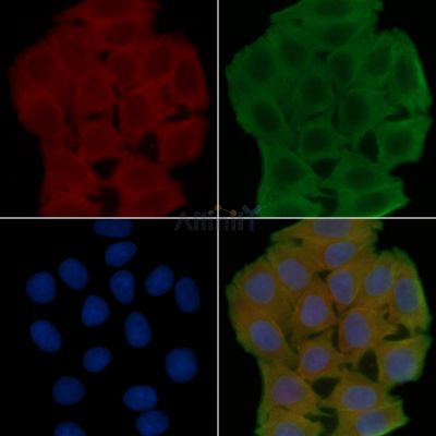 RAB18 Antibody - DF4395 staining Hela cells(45min of heat-shock treatment) by IF/ICC.