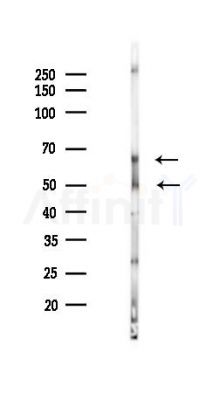 ALDH1A2 Antibody - Western blot analysis of lysates from Rat testis, using ALDH1A2 Antibody at 1/1000 dilution.