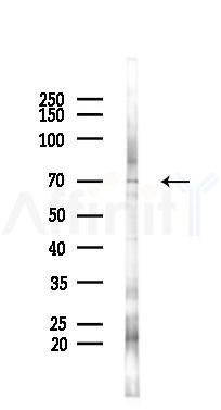 RBBP5 Antibody - Western blot analysis of lysates from K562 cells(heat-shock 45min treatment), using RBBP5 Antibody at 1/1000 dilution.