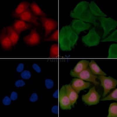 RBBP5 Antibody - DF4423 staining Hela cells(30min of UV treatment) by IF/ICC.