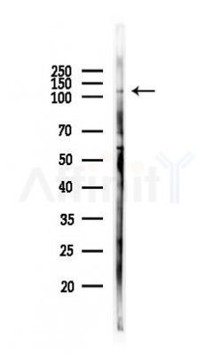 ARHGAP11A Antibody - Western blot analysis of lysates from 293 cells(heat-shock 45min treatment), using ARHGAP11A Antibody at 1/1000 dilution.